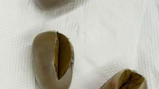 পায়ুপথে লুকিয়ে ৩টি ‘স্বর্ণের ডিম’, বিমানবন্দরে যাত্রী আটক