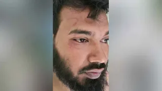 চট্টগ্রামে বনের জমিতে উচ্ছেদের জেরে বন কর্মকর্তাকে মারধর